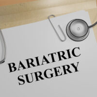 Bariatric Surgery is an excess skin removal surgery
